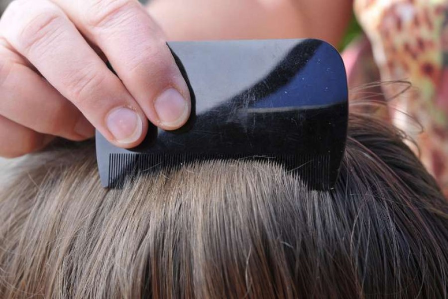 Բժիշկը թվարկել է ոջիլներից ազատվելու ամենավտանգավոր ժողովրդական միջոցները